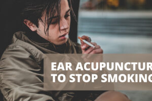 Ear Acupuncture to Stop Smoking