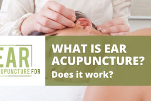 What is Ear Acupuncture, and Does it Work?
